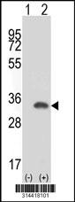 Western blot analysis of his-tag CCDC42 (arrow) using his tag antibody. 293 cell lysates (2 ug/lane) either nontransfected (Lane 1) or transiently transfected with the CCDC42 gene.