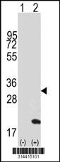 Western blot analysis of his-tag RNFT2 (arrow) using his tag antibody. 293 cell lysates (2 ug/lane) either nontransfected (Lane 1) or transiently transfected with the RNFT2 gene.