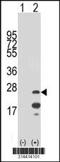 Western blot analysis of his-tag LAPTM4A (arrow) using his tag antibody. 293 cell lysates (2 ug/lane) either nontransfected (Lane 1) or transiently transfected with the LAPTM4A gene.