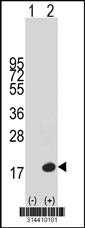 Western blot analysis of his-tag PQLC2 (arrow) using his tag antibody. 293 cell lysates (2 ug/lane) either nontransfected (Lane 1) or transiently transfected with the PQLC2 gene.