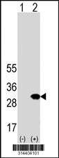 Western blot analysis of his-tag NDFIP1 (arrow) using his tag antibody. 293 cell lysates (2 ug/lane) either nontransfected (Lane 1) or transiently transfected with the NDFIP1 gene.