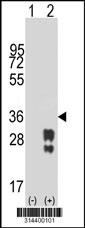 Western blot analysis of his-tag C9orf9 (arrow) using his tag antibody. 293 cell lysates (2 ug/lane) either nontransfected (Lane 1) or transiently transfected with the C9orf9 gene.