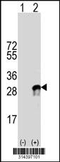 Western blot analysis of his-tag VPS28 (arrow) using his tag antibody. 293 cell lysates (2 ug/lane) either nontransfected (Lane 1) or transiently transfected with the VPS28 gene.
