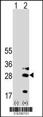 Western blot analysis of his-tag C1orf49 (arrow) using his tag antibody. 293 cell lysates (2 ug/lane) either nontransfected (Lane 1) or transiently transfected with the C1orf49 gene.