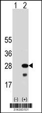 Western blot analysis of his-tag MAD2L2 (arrow) using his tag antibody. 293 cell lysates (2 ug/lane) either nontransfected (Lane 1) or transiently transfected with the MAD2L2 gene.