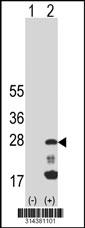 Western blot analysis of his-tag RAB38 (arrow) using his tag antibody. 293 cell lysates (2 ug/lane) either nontransfected (Lane 1) or transiently transfected with the RAB38 gene.