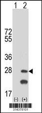 Western blot analysis of his-tag PPIF (arrow) using his tag antibody. 293 cell lysates (2 ug/lane) either nontransfected (Lane 1) or transiently transfected with the PPIF gene.