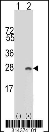 Western blot analysis of his-tag RPS5 (arrow) using his tag antibody. 293 cell lysates (2 ug/lane) either nontransfected (Lane 1) or transiently transfected with the RPS5 gene.