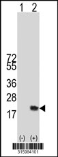 Western blot analysis of his-tag OCM (arrow) using his tag antibody. 293T cell lysates (2 ug/lane) either nontransfected (Lane 1) or transiently transfected with the OCM gene‘