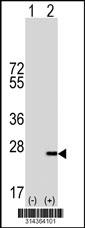 Western blot analysis of his-tag ITGB1BP1 (arrow) using his tag antibody. 293 cell lysates (2 ug/lane) either nontransfected (Lane 1) or transiently transfected with the ITGB1BP1 gene.