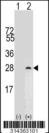 Western blot analysis of his-tag CRADD (arrow) using his tag antibody. 293 cell lysates (2 ug/lane) either nontransfected (Lane 1) or transiently transfected with the CRADD gene.