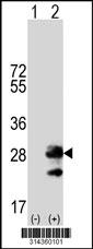 Western blot analysis of his-tag LOH12CR1 (arrow) using his tag antibody. 293 cell lysates (2 ug/lane) either nontransfected (Lane 1) or transiently transfected with the LOH12CR1 gene.