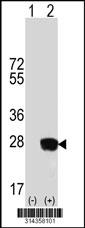 Western blot analysis of his-tag SLMO2 (arrow) using his tag antibody. 293 cell lysates (2 ug/lane) either nontransfected (Lane 1) or transiently transfected with the SLMO2 gene.