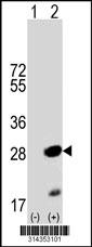 Western blot analysis of his-tag CBX5 (arrow) using his tag antibody. 293 cell lysates (2 ug/lane) either nontransfected (Lane 1) or transiently transfected with the CBX5 gene.