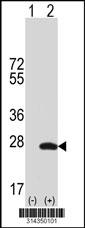Western blot analysis of his-tag RPL18 (arrow) using his tag antibody. 293 cell lysates (2 ug/lane) either nontransfected (Lane 1) or transiently transfected with the RPL18 gene.