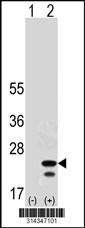 Western blot analysis of his-tag TNFAIP8L1 (arrow) using his tag antibody. 293 cell lysates (2 ug/lane) either nontransfected (Lane 1) or transiently transfected with the TNFAIP8L1 gene.