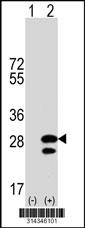 Western blot analysis of his-tag TNNI1 (arrow) using his tag antibody. 293 cell lysates (2 ug/lane) either nontransfected (Lane 1) or transiently transfected with the TNNI1 gene.