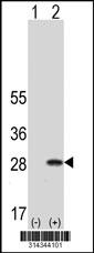 Western blot analysis of his-tag RAP1B (arrow) using his tag antibody. 293 cell lysates (2 ug/lane) either nontransfected (Lane 1) or transiently transfected with the RAP1B gene.