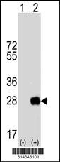 Western blot analysis of his-tag TIFA (arrow) using his tag antibody. 293 cell lysates (2 ug/lane) either nontransfected (Lane 1) or transiently transfected with the TIFA gene.
