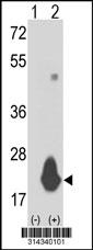 Western blot analysis of his-tag RNF208 (arrow) using his tag antibody. 293 cell lysates (2 ug/lane) either nontransfected (Lane 130) or transiently transfected with theRNF208 gene.