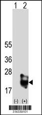 Western blot analysis of his-tag TRAPPC3 (arrow) using his tag antibody. 293 cell lysates (2 ug/lane) either nontransfected (Lane 1) or transiently transfected with the TRAPPC3 gene.