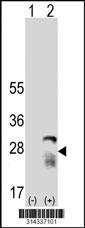 Western blot analysis of his-tag NUDT4 (arrow) using his tag antibody. 293 cell lysates (2 ug/lane) either nontransfected (Lane 1) or transiently transfected with the NUDT4 gene.