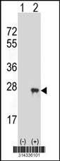 Western blot analysis of his-tag RGS10 (arrow) using his tag antibody. 293 cell lysates (2 ug/lane) either nontransfected (Lane 1) or transiently transfected with the RGS10 gene.