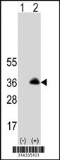 Western blot analysis of his-tag FXYD5 (arrow) using his tag antibody. 293 cell lysates (2 ug/lane) either nontransfected (Lane 1) or transiently transfected with the FXYD5 gene.