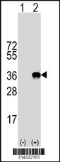 Western blot analysis of his-tag TOMM34 (arrow) using his tag antibody. 293 cell lysates (2 ug/lane) either nontransfected (Lane 1) or transiently transfected with the TOMM34 gene.
