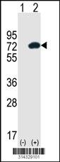 Western blot analysis of his-tag ROCK2 (arrow) using his tag antibody. 293 cell lysates (2 ug/lane) either nontransfected (Lane 1) or transiently transfected with the ROCK2 gene.