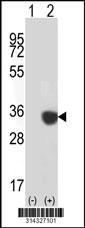 Western blot analysis of his-tag LHPP (arrow) using his tag antibody. 293 cell lysates (2 ug/lane) either nontransfected (Lane 1) or transiently transfected with the LHPP gene.