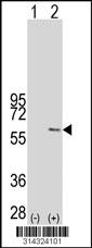 Western blot analysis of his-tag CYP4V2 (arrow) using his tag antibody. 293 cell lysates (2 ug/lane) either nontransfected (Lane 205) or transiently transfected with theCYP4V2 gene.