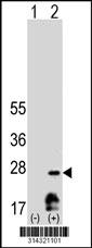 Western blot analysis of his-tag GCSH (arrow) using his tag antibody. 293 cell lysates (2 ug/lane) either nontransfected (Lane 1) or transiently transfected with the GCSH gene.