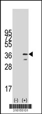 Western blot analysis of his-tag PQBP1 (arrow) using his tag antibody. 293T cell lysates (2 ug/lane) either nontransfected (Lane 1) or transiently transfected with the PQBP1 gene‘