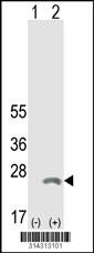 Western blot analysis of his-tag RANGRF (arrow) using his tag antibody. 293 cell lysates (2 ug/lane) either nontransfected (Lane 1) or transiently transfected with the RANGRF gene.