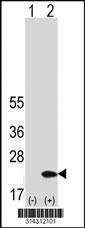 Western blot analysis of his-tag THYN1 (arrow) using his tag antibody. 293 cell lysates (2 ug/lane) either nontransfected (Lane 1) or transiently transfected with the THYN1 gene.