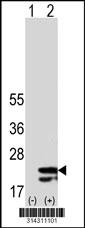 Western blot analysis of his-tag STK32A (arrow) using his tag antibody. 293 cell lysates (2 ug/lane) either nontransfected (Lane 1) or transiently transfected with the STK32A gene.