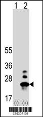 Western blot analysis of his-tag RNASE1 (arrow) using his tag antibody. 293 cell lysates (2 ug/lane) either nontransfected (Lane 1) or transiently transfected with the RNASE1 gene.