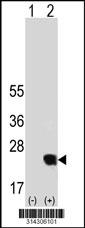 Western blot analysis of his-tag TNNC2 (arrow) using his tag antibody. 293 cell lysates (2 ug/lane) either nontransfected (Lane 1) or transiently transfected with the TNNC2 gene.
