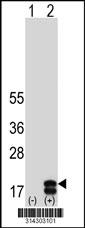 Western blot analysis of his-tag ORMDL1 (arrow) using his tag antibody. 293 cell lysates (2 ug/lane) either nontransfected (Lane 1) or transiently transfected with the ORMDL1 gene.