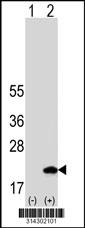 Western blot analysis of his-tag DNAL1 (arrow) using his tag antibody. 293 cell lysates (2 ug/lane) either nontransfected (Lane 1) or transiently transfected with the DNAL1 gene.