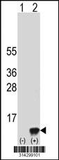 Western blot analysis of his-tag ACBD7 (arrow) using his tag antibody. 293 cell lysates (2 ug/lane) either nontransfected (Lane 1) or transiently transfected with the ACBD7 gene.