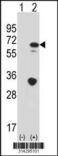 Western blot analysis of his-tag C1R (arrow) using his tag antibody. 293 cell lysates (2 ug/lane) either nontransfected (Lane 1) or transiently transfected with the C1R gene.