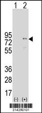 Western blot analysis of his-tag PRKCB (arrow) using his tag antibody. 293 cell lysates (2 ug/lane) either nontransfected (Lane 198) or transiently transfected with thePRKCB gene.