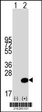 Western blot analysis of his-tag C11orf51 (arrow) using his tag antibody. 293 cell lysates (2 ug/lane) either nontransfected (Lane 1) or transiently transfected with the C11orf51 gene.