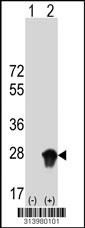 Western blot analysis of his-tag TMED5 (arrow) using his tag antibody. 293 cell lysates (2 ug/lane) either nontransfected (Lane 128) or transiently transfected with theTMED5 gene.