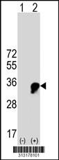 Western blot analysis of his-tag CLDND1 (arrow) using his tag antibody. 293 cell lysates (2 ug/lane) either nontransfected (Lane 1) or transiently transfected with the CLDND1 gene.