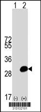 Western blot analysis of his-tag RNF114 (arrow) using his tag antibody. 293 cell lysates (2 ug/lane) either nontransfected (Lane 1) or transiently transfected with the RNF114 gene.