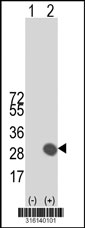 Western blot analysis of his-tag LNP1 (arrow) using his tag antibody. 293T cell lysates (2 ug/lane) either nontransfected (Lane 1) or transiently transfected with the LNP1 gene‘