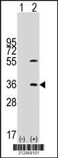 Western blot analysis of his-tag LGALS8 (arrow) using his tag antibody. 293 cell lysates (2 ug/lane) either nontransfected (Lane 1) or transiently transfected with the LGALS8 gene.